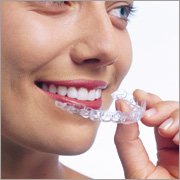 Invisalign Aligner