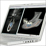 Navigierte Implantologie